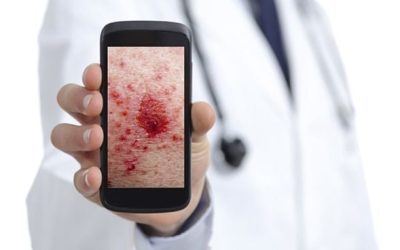 Curso de Fotografía Dermatológica con Smartphone