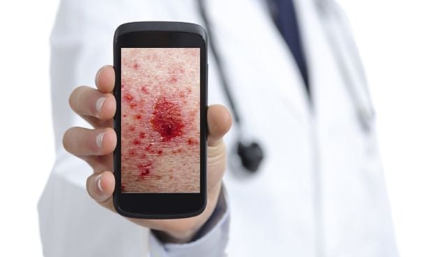 Curso de Fotografía Dermatológica con Smartphone
